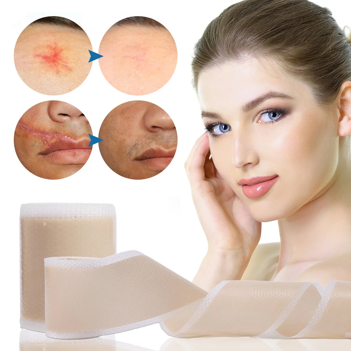 Waterproof Silicone Scar Sheet Roll