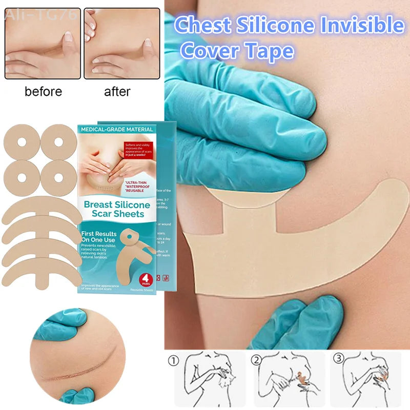 Invisible Silicone Chest Scar Patches